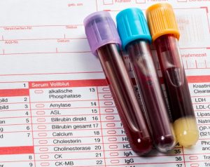 analisis-clinicos-pruebas-de-antidoping