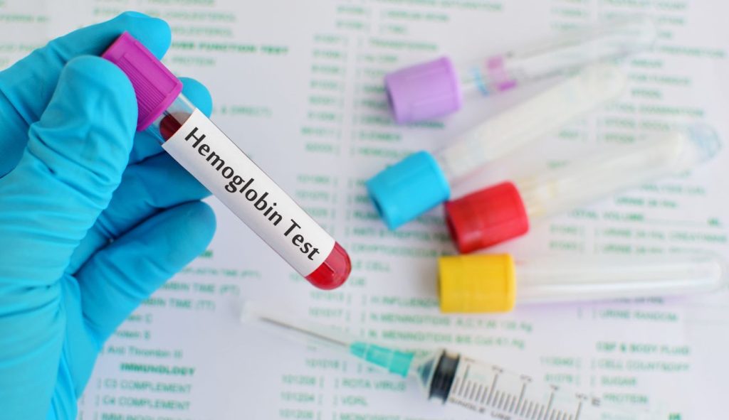 prueba-hemoglobina-glicosilada-laboratorio-interlab.jpg