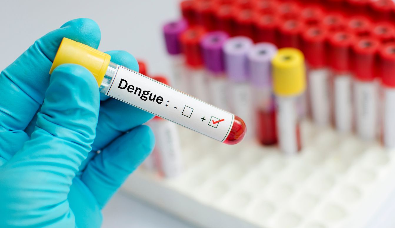 prevenir-el-dengue-laboratorios-en-cuernavaca-quality